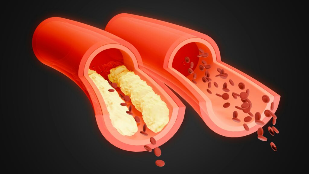 restore blood flow vascular health